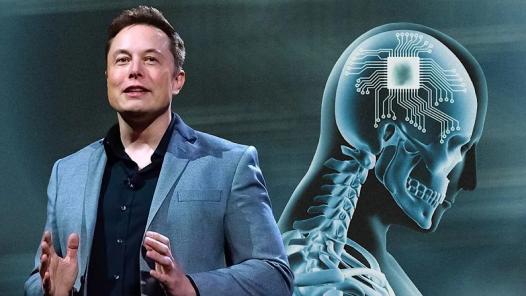 Neuralink là gì?